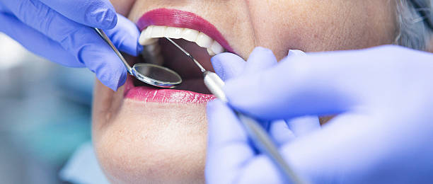 Best Emergency Gum Treatment in Bevil Oaks, TX